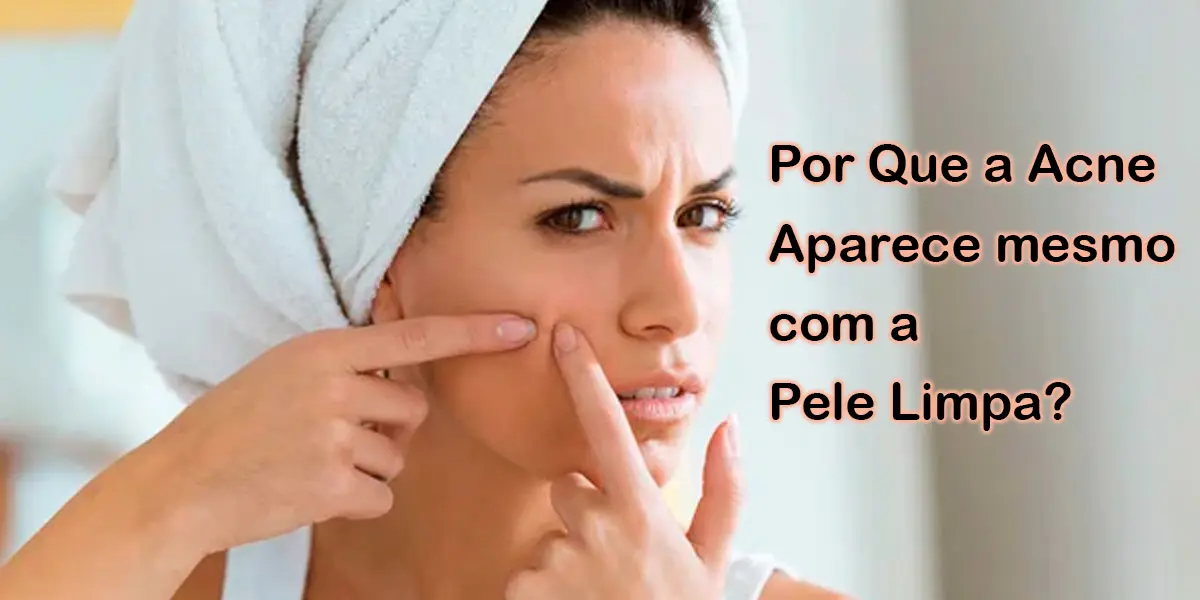 Por Que a Acne Aparece Mesmo com a Pele Limpa?